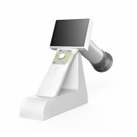 Handheld Non-mydriatic Retinal Camera