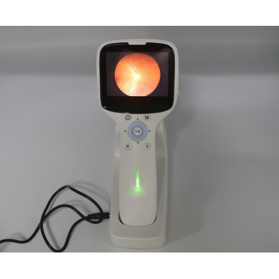 Non-mydriatic Portable Digital Fundus Camera