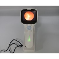 Non-mydriatic Portable Digital Fundus Camera