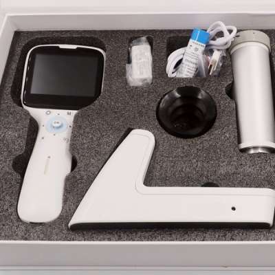 Non-mydriatic Fundus Camera Portable Retinal Camera